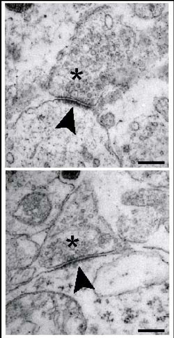 Synaptic vesicles in the presynaptic terminal (asterisk).